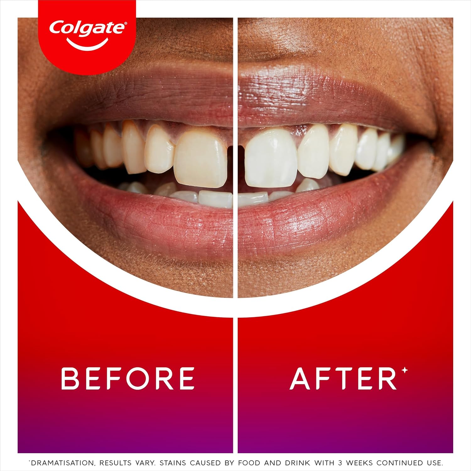 Colgate Max White Ultimate Radiance Whitening Toothpaste 75ml - 10X whiter teeth* - Instant teeth whitening toothpaste^ - Deeply* whitens - Helps prevent future stains - Enamel safe for daily use